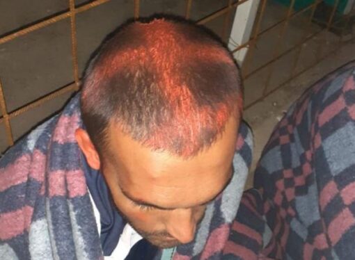 Poliţia croată, acuzată că marchează cu vopsea capetele refugiaţilor care solicită azilul în ţară. ONU a cerut anchetă