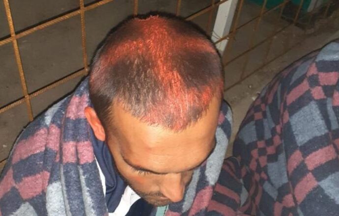Poliţia croată, acuzată că marchează cu vopsea capetele refugiaţilor care solicită azilul în ţară. ONU a cerut anchetă